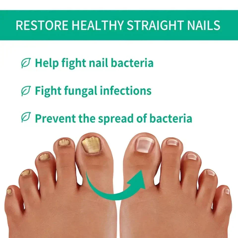 NexusDrop Nail Fungus Solution