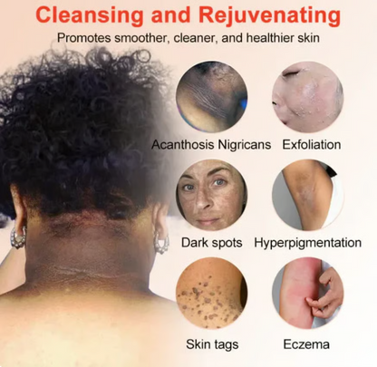 Orange Enzyme Exfoliating Gel (Free Delivery + Allowed To Open Parcel)