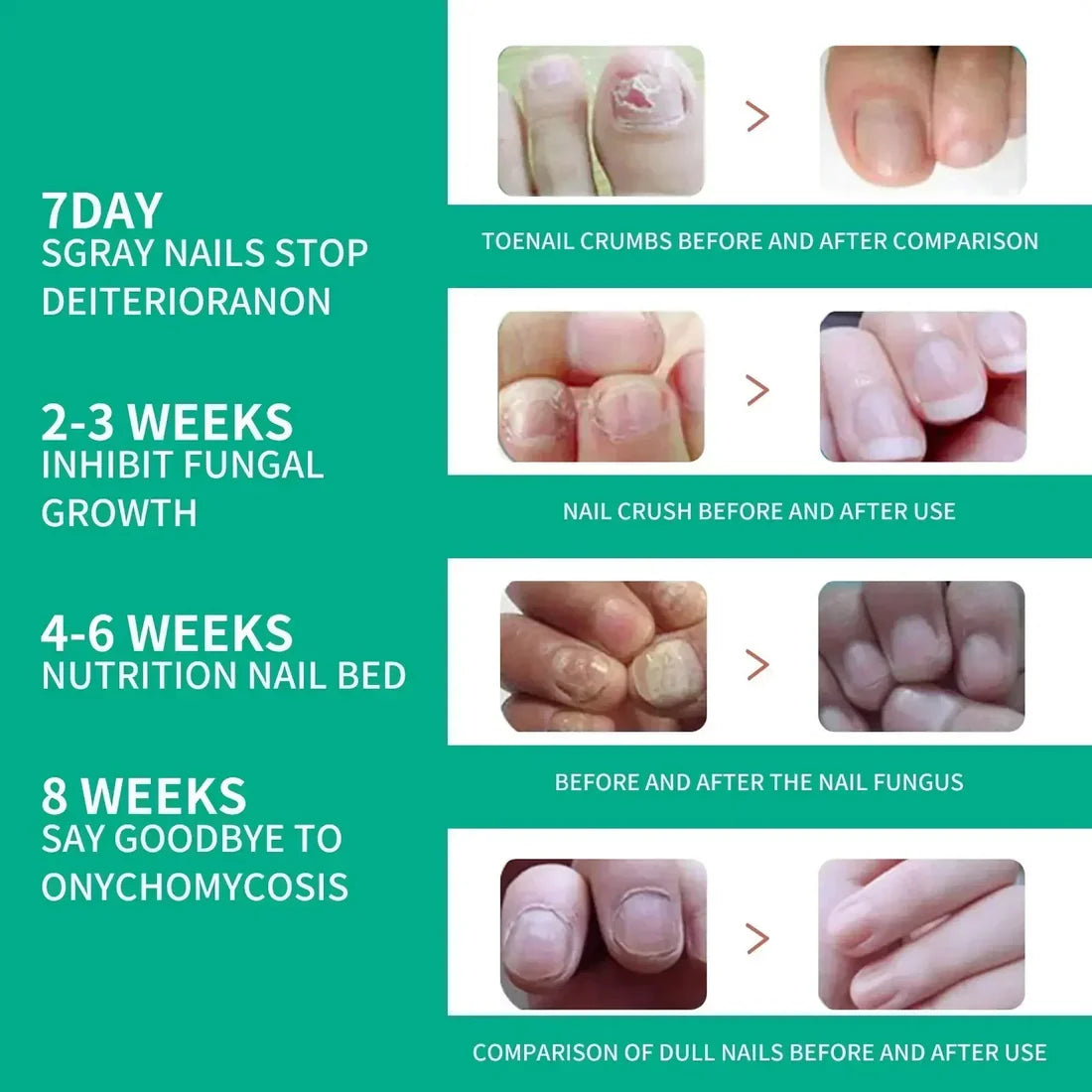NexusDrop Nail Fungus Solution